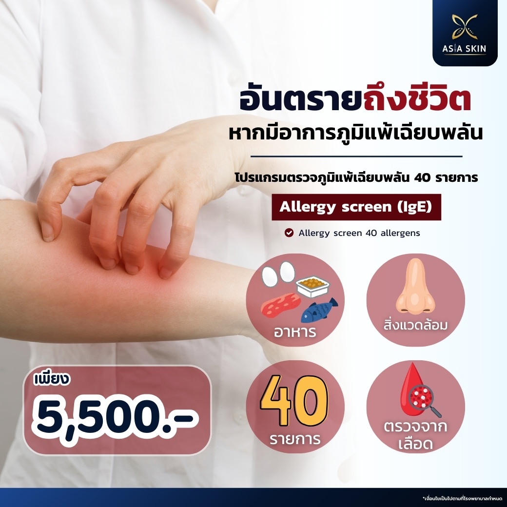 ตรวจภูมิแพ้เฉียบพลัน (IgE) Allergy Screen